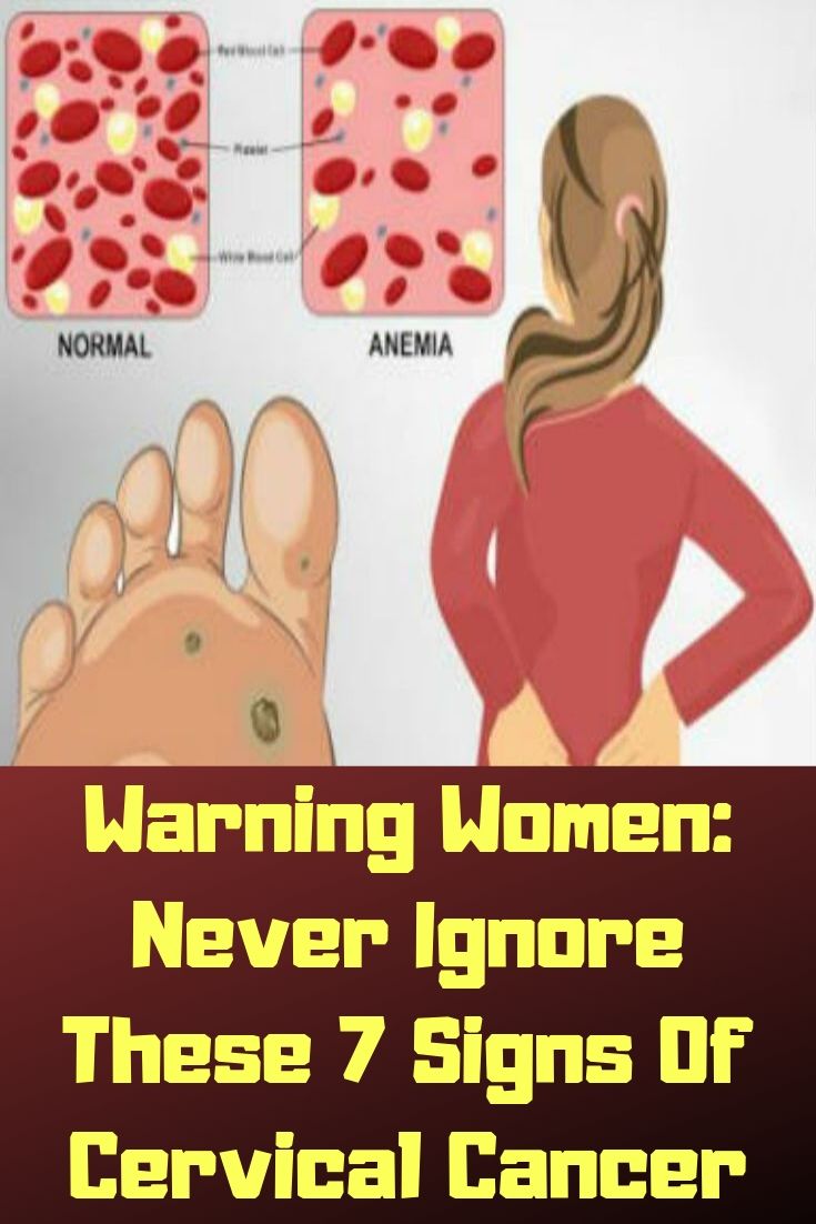WARNING WOMEN: NEVER IGNORE THESE 7 SIGNS OF CERVICAL CANCER