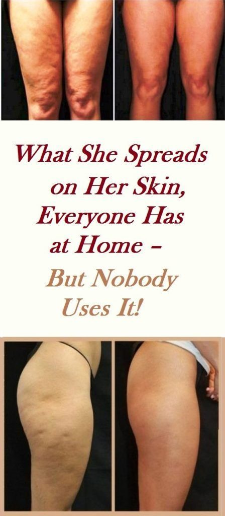 WHAT SHE SPREADS ON HER SKIN, EVERYONE HAS AT HOME – BUT NOBODY USES IT!