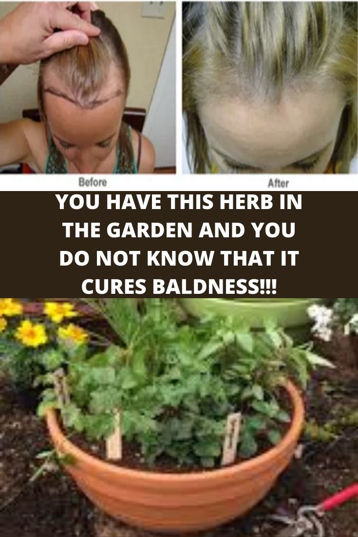 YOU HAVE THIS HERB IN THE GARDEN AND YOU DO NOT KNOW THAT IT CURES BALDNESS!!!