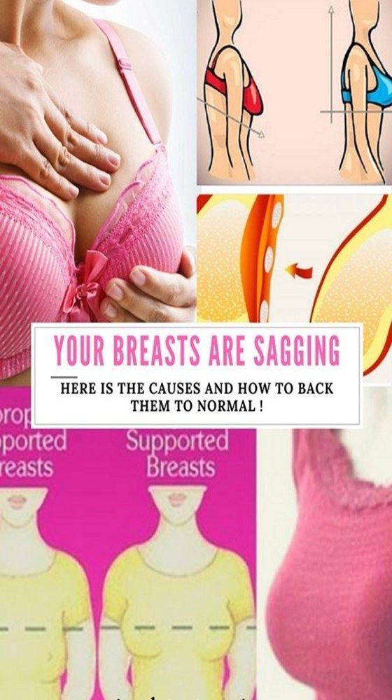 YOUR BREASTS ARE SAGGING-HERE IS THE CAUSES AND HOW TO BACK THEM TO NORMAL !
